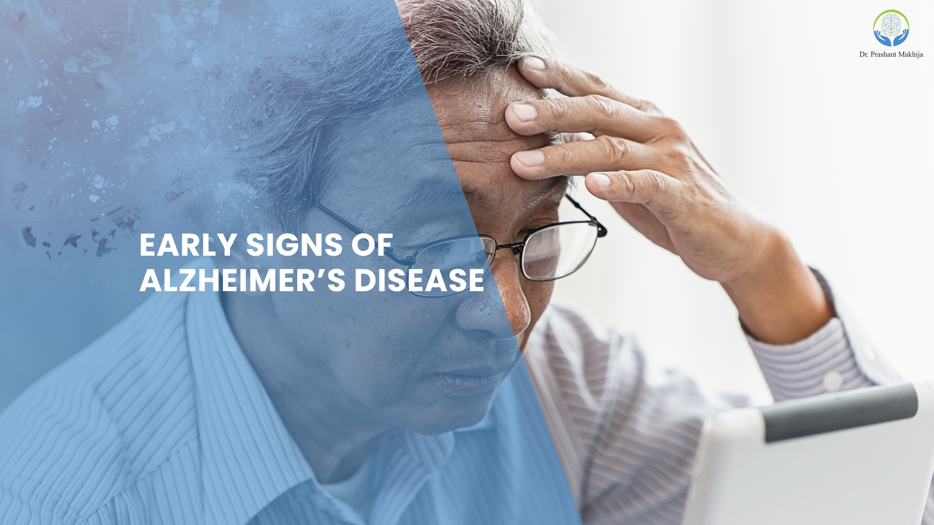 Read more about the article Early Signs of Alzheimer’s Disease You Should Know